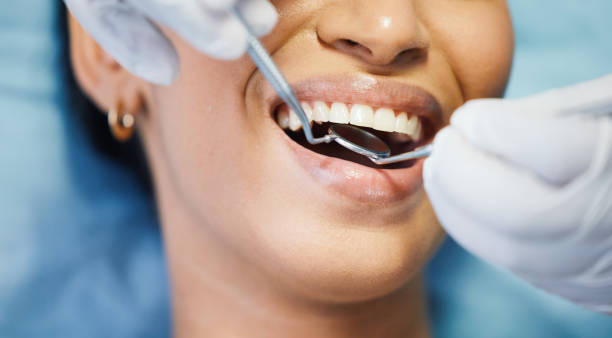 Best Broken or Chipped Tooth Repair in Como, WI