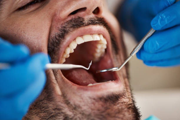 Best Emergency Dental Care for Sports Injuries in Como, WI